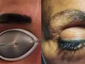 Permanent Make-up entfernen: Was wirklich hilft & Sie erwartet