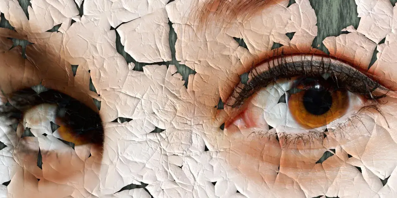 Nahaufnahme von Augen mit rissiger, trockener Haut.