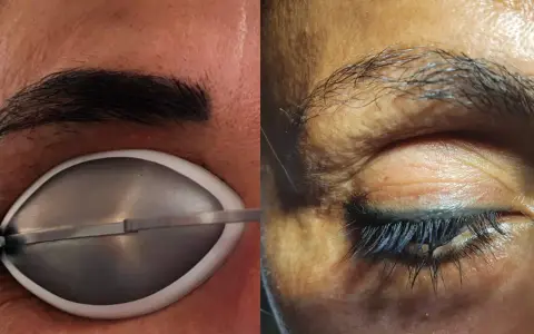 Permanent Make-up entfernen: Was wirklich hilft & Sie erwartet