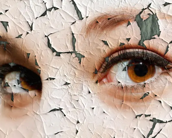 Nahaufnahme von Augen mit rissiger, trockener Haut.