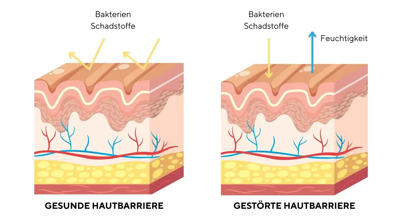 Hautbarriere schematisch oder wirksame Inhaltsstoffe für trockene Haut