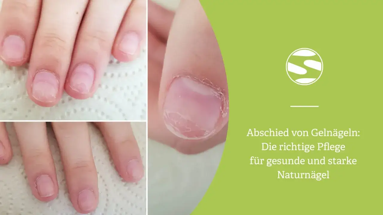 Nagelpflege nach Gelnägel Entfernung