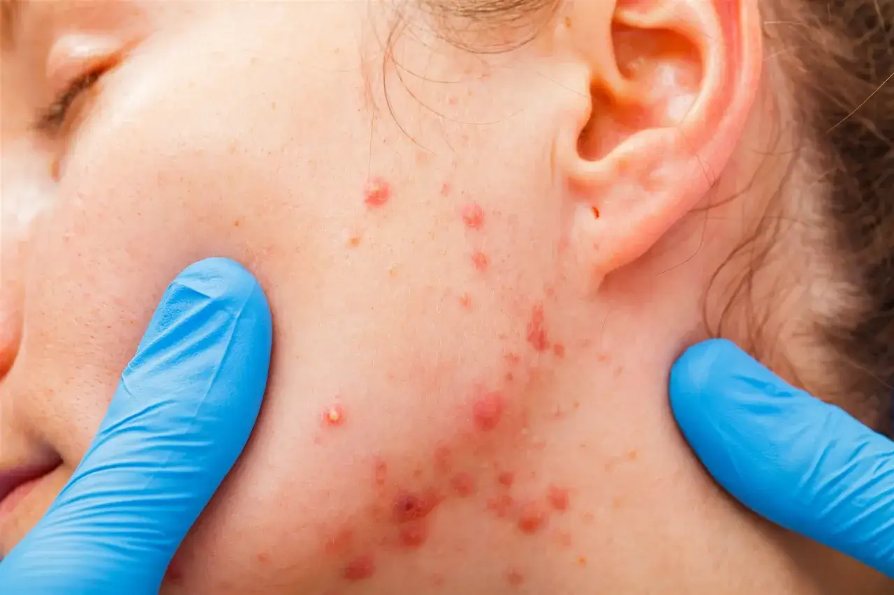 dermatologe beratung hautprobleme