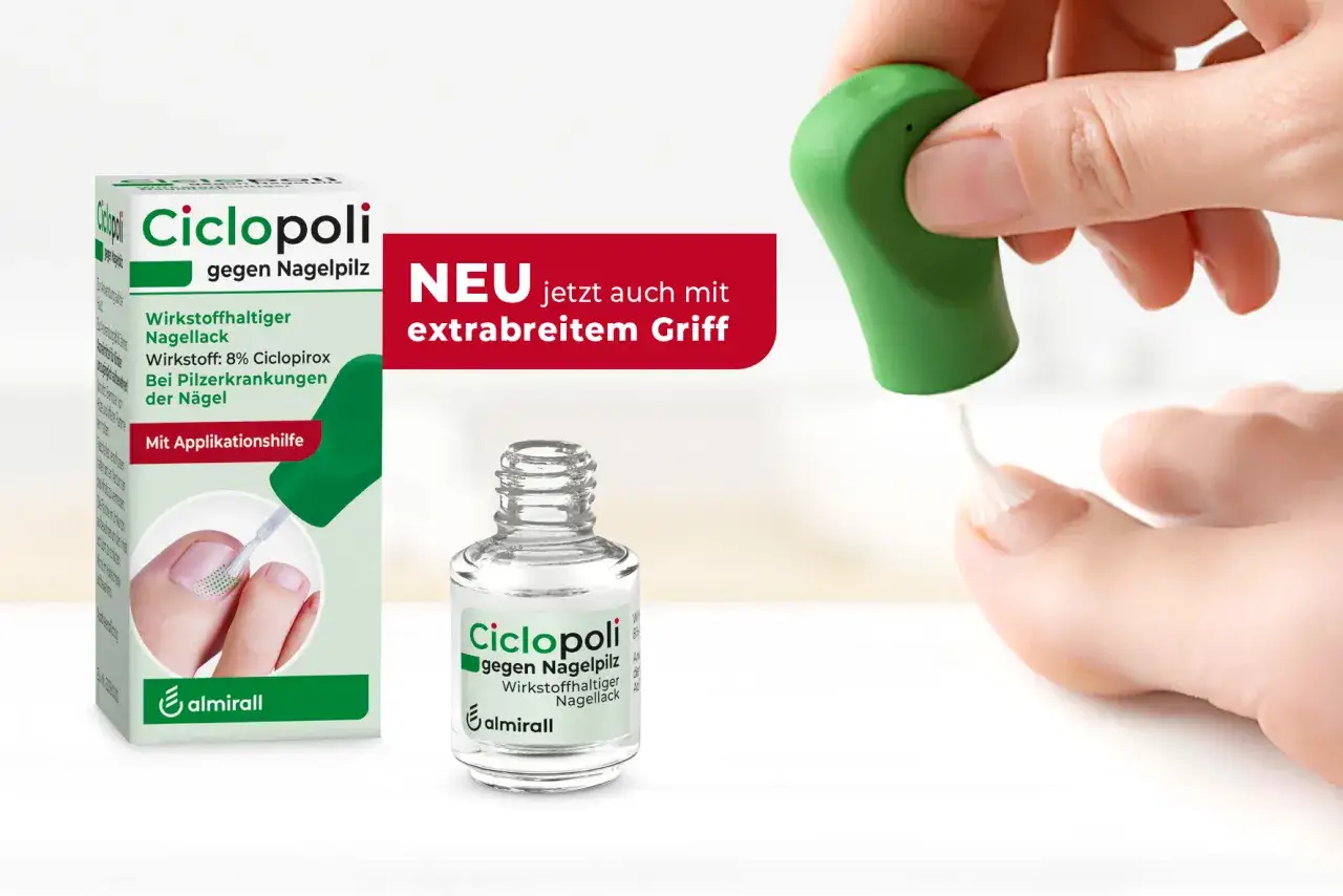 Ciclopoli behandelter Nagel mit wei&szlig;en Flecken